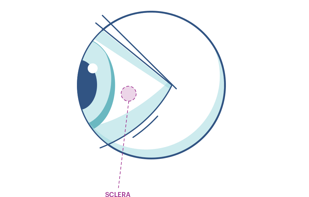 Ilustración de un ojo indicando la esclera